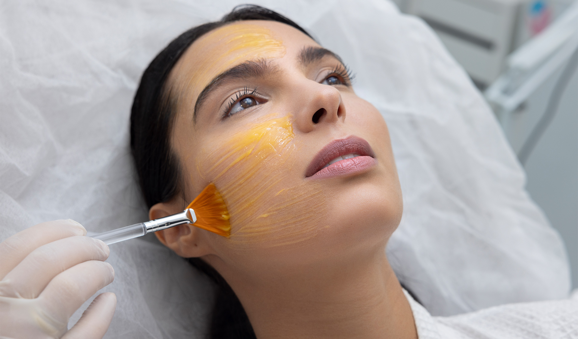HYPERPIGMENTATION CHEMICAL PEEL - Maris Clinic