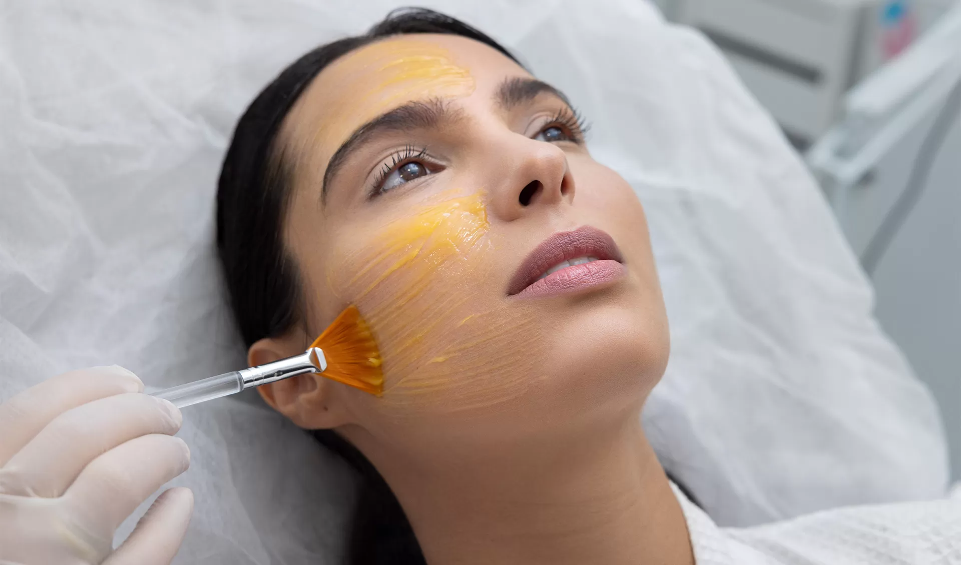 HYPERPIGMENTATION CHEMICAL PEEL - Maris Clinic